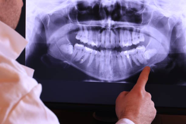 Best Emergency Treatment for Oral Infections in Val Verde Park, TX